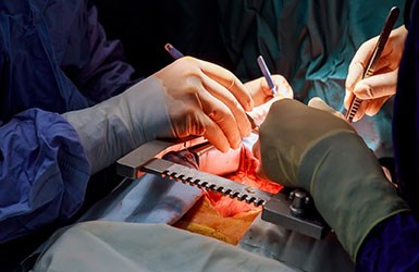 Cardiothoracic Surgery