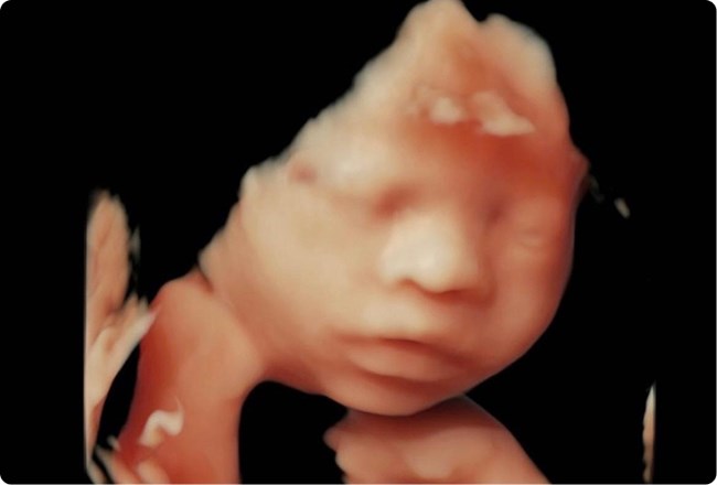 Advanced Prenatal Diagnosis
