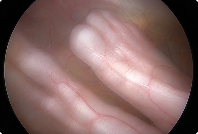 Fetal Therapy and Surgery