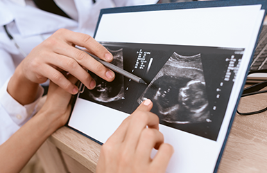 Gynecology Division Gynecology Division